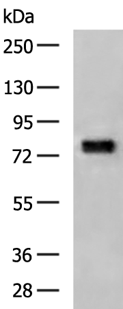 Rabbit Polyclonal Antibody to FSHR