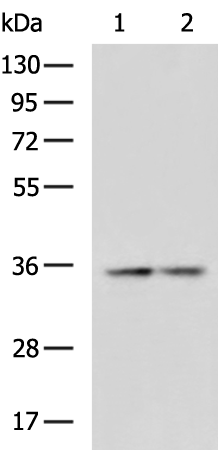 Rabbit Polyclonal Antibody to KLF7