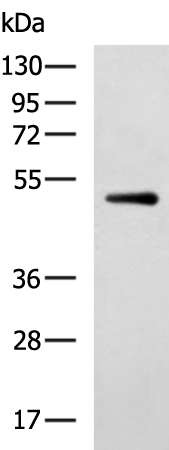 Rabbit Polyclonal Antibody to LCAT