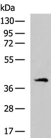 Rabbit Polyclonal Antibody to SPDEF