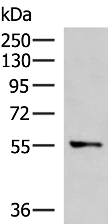 Rabbit Polyclonal Antibody to TEKT5
