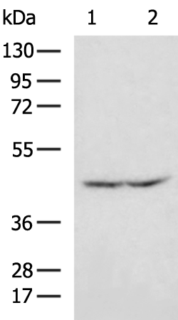 Rabbit Polyclonal Antibody to NCEH1