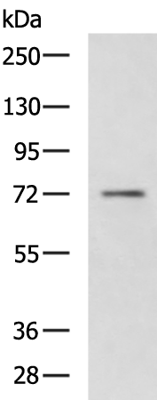 Rabbit Polyclonal Antibody to AKAP8L