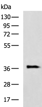 Rabbit Polyclonal Antibody to AKR1B10