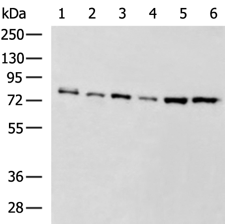Rabbit Polyclonal Antibody to ATXN1