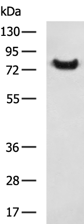 Rabbit Polyclonal Antibody to SCNN1G