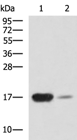 Rabbit Polyclonal Antibody to UBE2B