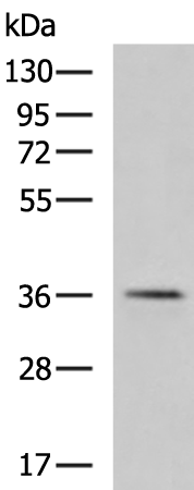 Rabbit Polyclonal Antibody to ATXN7L3