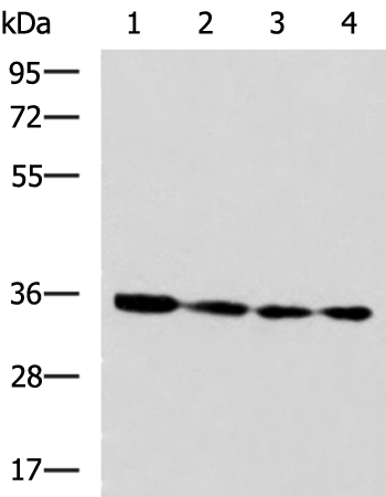 Rabbit Polyclonal Antibody to NUDT22