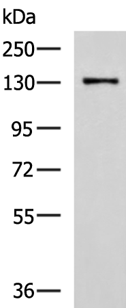 Rabbit Polyclonal Antibody to CASR