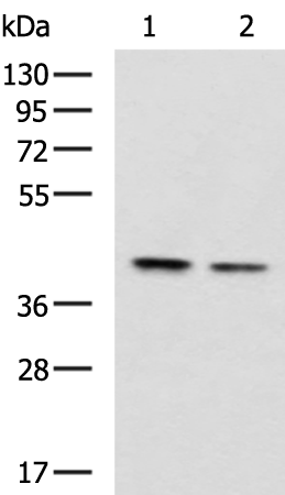 Rabbit Polyclonal Antibody to CSNK2A2