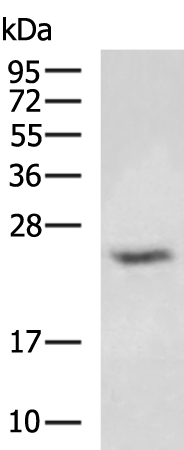 Rabbit Polyclonal Antibody to GINS2