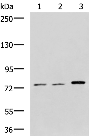 Rabbit Polyclonal Antibody to GRIK2