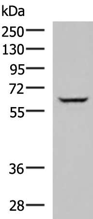 Rabbit Polyclonal Antibody to ACVR1B