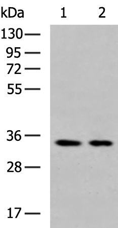 Rabbit Polyclonal Antibody to CCN2