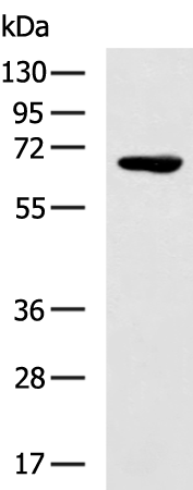 Rabbit Polyclonal Antibody to BEST1