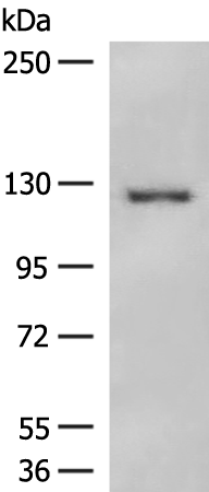 Rabbit Polyclonal Antibody to NFASC