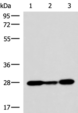 Rabbit Polyclonal Antibody to VEGFA