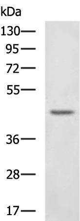 Rabbit Polyclonal Antibody to NDRG2
