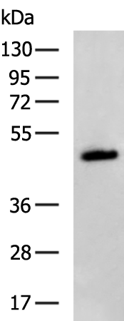 Rabbit Polyclonal Antibody to SCTR