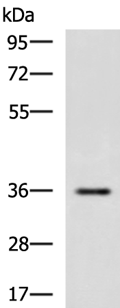 Rabbit Polyclonal Antibody to IBSP