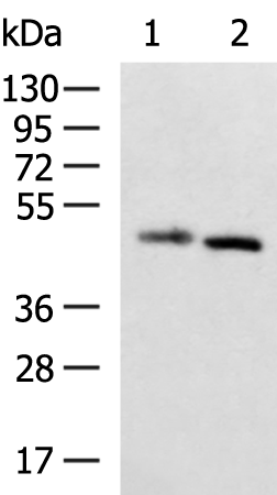 Rabbit Polyclonal Antibody to DIPK2B