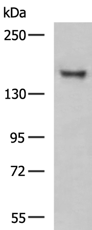 Rabbit Polyclonal Antibody to KDM5B