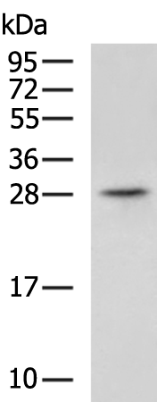 Rabbit Polyclonal Antibody to OSM