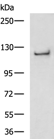 Rabbit Polyclonal Antibody to ZMIZ1
