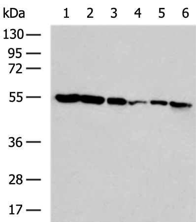 Rabbit Polyclonal Antibody to SESN2