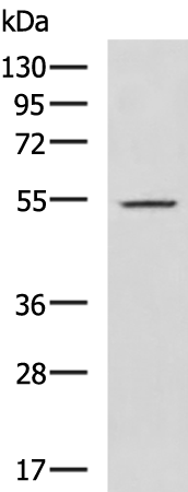 Rabbit Polyclonal Antibody to ENTPD1