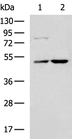 Rabbit Polyclonal Antibody to SMYD2