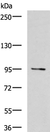 Rabbit Polyclonal Antibody to E2F8
