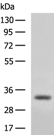 Rabbit Polyclonal Antibody to EFNB3