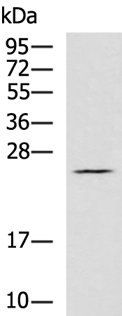 Rabbit Polyclonal Antibody to CDC34