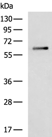 Rabbit Polyclonal Antibody to MEN1