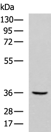 Rabbit Polyclonal Antibody to ABHD6