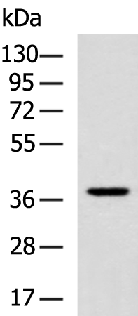 Rabbit Polyclonal Antibody to VGLL3