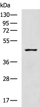 Rabbit Polyclonal Antibody to VPS36