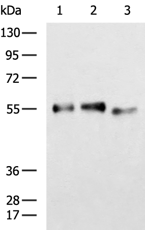 Rabbit Polyclonal Antibody to CORO1A