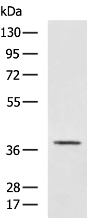 Rabbit Polyclonal Antibody to IL12B