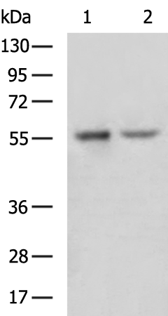 Rabbit Polyclonal Antibody to FANCE