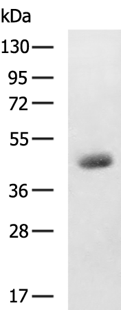 Rabbit Polyclonal Antibody to PTGDR2