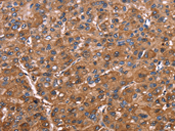 Rabbit Polyclonal Antibody to ELP2