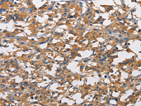 Rabbit Polyclonal Antibody to NT5E
