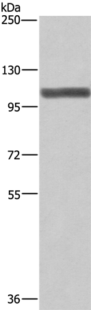 Rabbit Polyclonal Antibody to XPO1