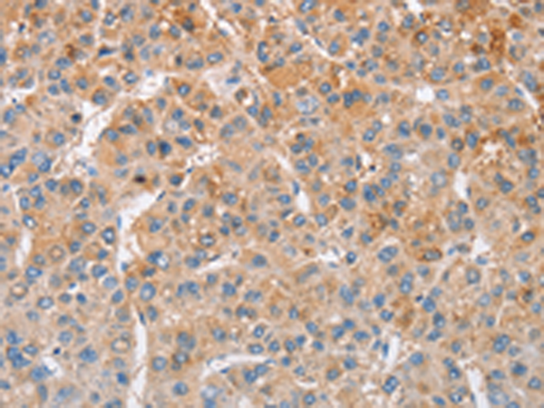 Rabbit Polyclonal Antibody to MTMR4