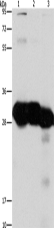 Rabbit Polyclonal Antibody to KHK