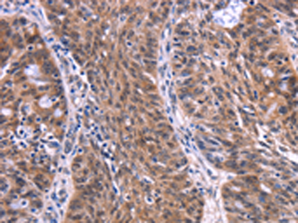 Rabbit Polyclonal Antibody to EIF2AK4