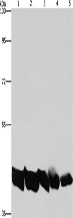 Rabbit Polyclonal Antibody to PGK1